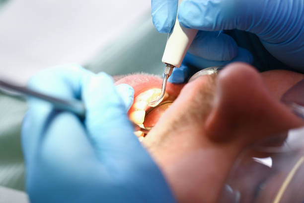 Best Emergency Care for Gum Disease in Swartzville, PA