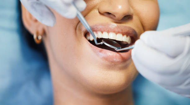 Best Dental Abscess Treatment in Swartzville, PA